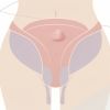 Identifier et comprendre les causes d'un bouton dans la vulve